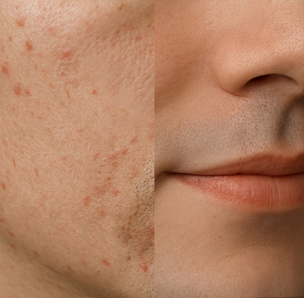 Better Skin Appearance